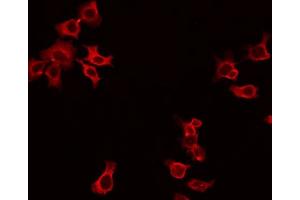 ABIN6266893 staining HepG2 by IF/ICC. (DOK3 antibody  (Internal Region))