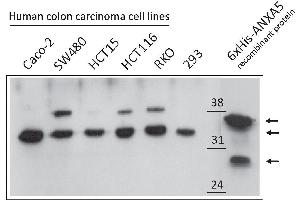 Western Blotting (WB) image for anti-Annexin A5 (ANXA5) antibody (ABIN2703593) (Annexin V antibody)