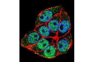 Confocal immunofluorescent analysis of TRADD Antibody (Center) with Hela cell followed by Alexa Fluor 488-conjugated goat anti-rabbit lgG (green). (TRADD antibody  (Middle Region))