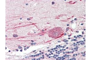 Human Brain, Cerebellum (formalin-fixed, paraffin-embedded) stained with TLR3at 5 µg/ml followed by biotinylated goat anti-rabbit IgG secondary antibody, alkaline phosphatase-streptavidin and chromogen. (TLR3 antibody  (C-Term))