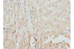 Immunohistochemistry of paraffin-embedded human liver tissue using ABIN7152931 at dilution of 1:100 (FCN1 antibody  (AA 30-326))
