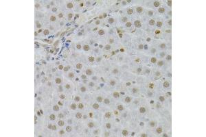 Immunohistochemistry of paraffin-embedded human liver using SFN Antibody. (14-3-3 sigma/SFN antibody  (AA 1-248))