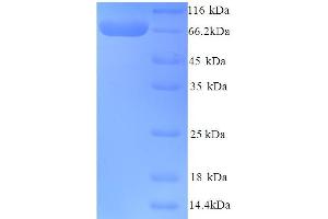 SDS-PAGE (SDS) image for Butyrylcholinesterase (BCHE) (AA 29-602) protein (His tag) (ABIN5713278)