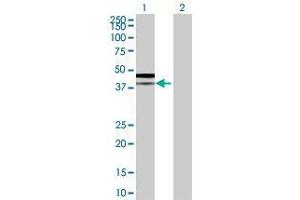 Lane 1: PPM1K transfected lysate ( 41. (PPM1K 293T Cell Transient Overexpression Lysate(Denatured))