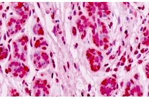 Human Breast, Epithelium: Formalin-Fixed, Paraffin-Embedded (FFPE) (UBE2D1 antibody  (AA 1-95))