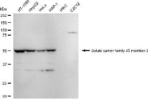 anti-Solute Carrier Family 45, Member 3 (SLC45A3) antibody