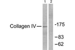 Western blot analysis of extracts from HeLa cells, using Collagen IV Antibody. (Collagen IV antibody  (AA 11-60))