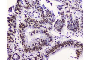 IHC analysis of RbAp48 using anti-RbAp48 antibody (ABIN5692929).