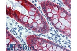 Immunohistochemistry staining of human colon (paraffin sections) using anti-cytokeratin 18 (clone Commercially tested by LifeSpan BioSciences. (Cytokeratin 18 antibody  (Biotin))