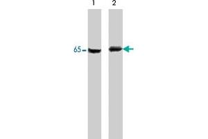 Western blot of A-431 cells untreated (lane 1) or treated with pervanadate (lane 2). (PDPK1 antibody  (N-Term))