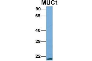 Host:  Rabbit  Target Name:  MUC1  Sample Type:  721_B  Antibody Dilution:  1. (MUC1 antibody  (N-Term))