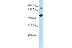 TBC1D16 antibody used at 1 ug/ml to detect target protein. (TBC1D16 antibody  (Middle Region))