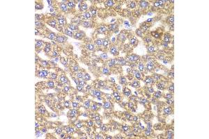 Immunohistochemistry of paraffin-embedded rat liver using UGDH antibody (ABIN6293152) at dilution of 1:100 (40x lens). (UGDH antibody)