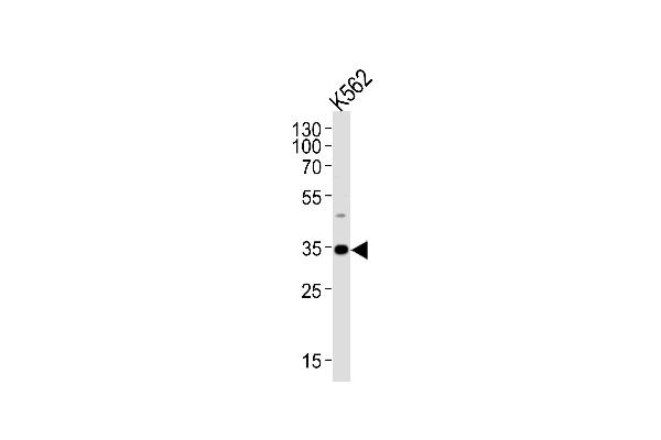 BBS5 antibody  (AA 108-141)