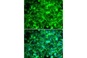 Immunofluorescence analysis of U2OS cells using ADIPOR1 antibody (ABIN5970705).