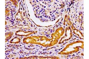 Immunohistochemistry of paraffin-embedded human kidney tissue using ABIN7145438 at dilution of 1:100 (ADRBK2 antibody  (AA 343-480))