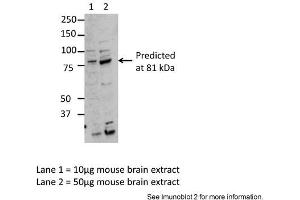 Sample Type: Lane1 = 10ug mouse brain extract, Lane 2 = 50ug mouse brain extractPrimary Antibody Dilution: Anti-MARK3 1:2500Submitted By: Dr. (MARK3 antibody  (Middle Region))