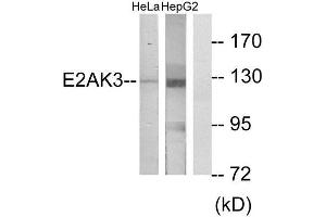 Western Blotting (WB) image for anti-Eukaryotic Translation Initiation Factor 2-alpha Kinase 3 (EIF2AK3) (N-Term) antibody (ABIN1850024)