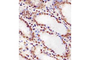 (ABIN6243590 and ABIN6578256) staining HNRNPUL2 in human stomach tissue sections by Immunohistochemistry (IHC-P - paraformaldehyde-fixed, paraffin-embedded sections). (HNRNPUL2 antibody  (AA 337-350))