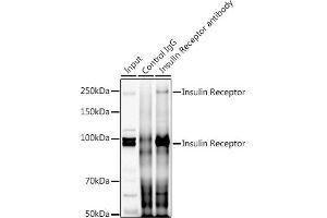 Immunoprecipitation analysis of 300 μg extracts of HeLa cells using 3 μg Insulin Receptor antibody (ABIN7267890). (Insulin Receptor antibody  (AA 1281-1382))