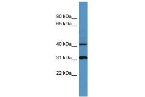 WB Suggested Anti-Ctsd Antibody Titration: 0. (Cathepsin D antibody  (C-Term))