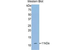 Detection of Recombinant COL2, Human using Polyclonal Antibody to Collagen Type II Alpha 1 (COL2a1) (COL2A1 antibody  (AA 1386-1467))