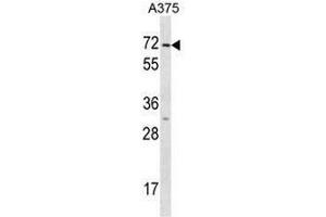 KRT75 Antibody (N-term) western blot analysis in A375 cell line lysates (35µg/lane).