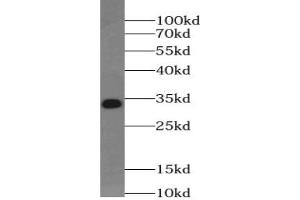 Western blot analysis of Jurkat cells subjected to SDS-PAGE using UCK2 Antibody at a dilution of 1/500.