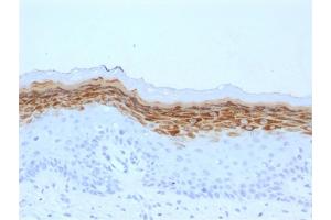 Formalin-fixed, paraffin-embedded human Skin stained with Filaggrin Mouse Monoclonal Antibody (FLG/1561). (Filaggrin antibody  (AA 198-288))