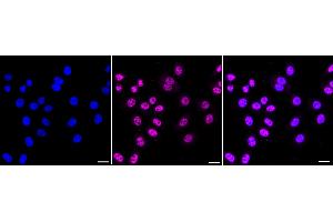 Immunocytochemical staining of HepG2 cells with Mediator complex subunit 4 antibody (ABIN7799350), 1:1,000). (Recombinant Mediator Complex antibody  (Subunit 4))