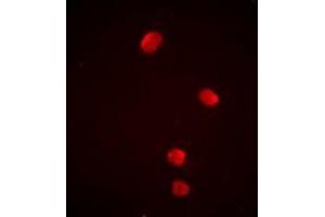 Immunofluorescent analysis of PSMD13 staining in Jurkat cells. (PSMD13 antibody)