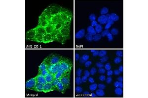 ABIN570961 Immunofluorescence analysis of paraformaldehyde fixed A431 cells, permeabilized with 0. (TJP1 antibody  (Internal Region))