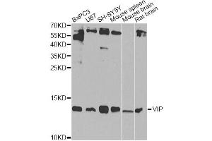 Western blot analysis of extracts of various cell lines, using VIP Antibody. (Vip antibody)