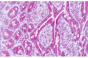 Image no. 2 for anti-Mitochondrial Ribosomal Protein L12 (MRPL12) (AA 87-136) antibody (ABIN6749796) (MRPL12 antibody  (AA 87-136))