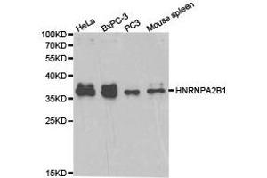 Western Blotting (WB) image for anti-Heterogeneous Nuclear Ribonucleoprotein A2/B1 (HNRNPA2B1) antibody (ABIN1873065)