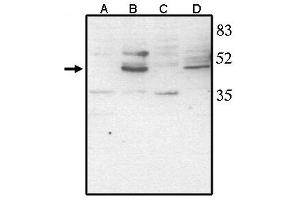 Western Blotting (WB) image for anti-Visual System Homeobox 2 (VSX2) antibody (ABIN293468) (VSX2 antibody)