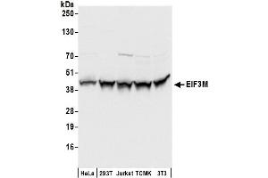 anti-Eukaryotic Translation Initiation Factor 3, Subunit M (EIF3M) (AA 1-50) antibody