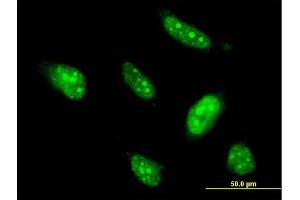 Immunofluorescence of monoclonal antibody to BTG4 on HeLa cell. (BTG4 antibody  (AA 1-206))