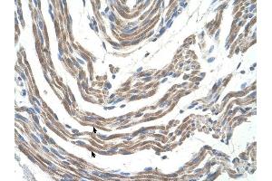 STK11 antibody was used for immunohistochemistry at a concentration of 4-8 ug/ml to stain Skeletal muscle cells (arrows) in Human Muscle. (LKB1 antibody  (N-Term))