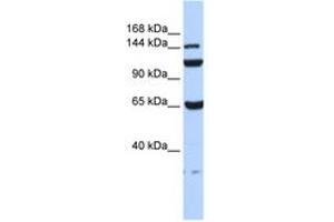Image no. 1 for anti-Chromosome 17 Open Reading Frame 57 (C17orf57) (AA 72-121) antibody (ABIN6741196) (C17orf57 antibody  (AA 72-121))