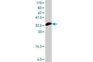 Western Blot detection against Immunogen (37 KDa) . (PLA2G12A antibody  (AA 90-188))