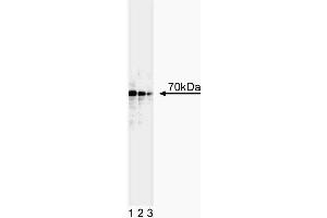 Western blot analysis of p73. (Tumor Protein p73 antibody  (AA 380-367))