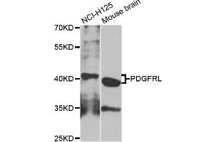 Western blot analysis of extracts of NCI-H125 cells, using PDGFRL antibody (ABIN5995942) at 1/1000 dilution. (PDGFRL antibody)