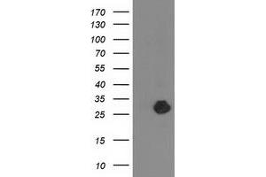 Western Blotting (WB) image for anti-Zinc Finger, AN1-Type Domain 2B (ZFAND2B) antibody (ABIN1501804) (ZFAND2B antibody)