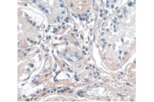 Detection of APOA1 in Human Stomach Tissue using Monoclonal Antibody to Apolipoprotein A1 (APOA1) (APOA1 antibody  (AA 122-267))