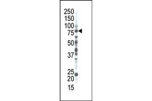 Image no. 1 for anti-Ribophorin II (RPN2) (N-Term) antibody (ABIN357701) (Ribophorin II antibody  (N-Term))