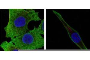 Confocal immunofluorescence analysis of PANC-1 (left) and SKBR-3 (right) cells using SOD1 mouse mAb (green). (SOD1 antibody)