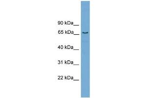 WB Suggested Anti-PPP2R5D Antibody Titration: 0. (PPP2R5D antibody  (Middle Region))