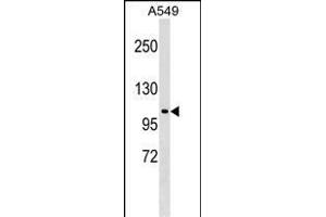 HECTD3 antibody  (C-Term)