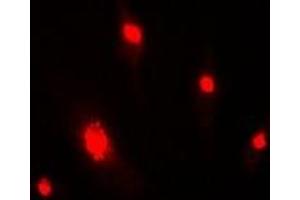 Immunofluorescent analysis of DDB2 staining in MCF7 cells. (DDB2 antibody)